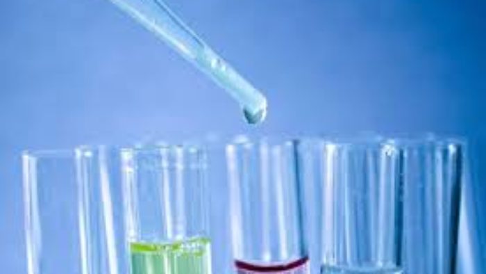 Asit Test Oranı Ne Demek?